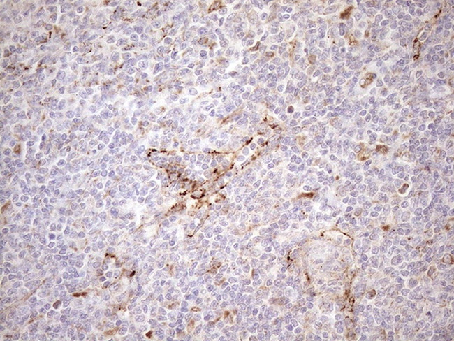 KCTD9 Antibody in Immunohistochemistry (Paraffin) (IHC (P))