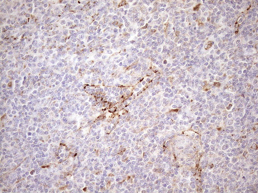 KCTD9 Antibody in Immunohistochemistry (Paraffin) (IHC (P))