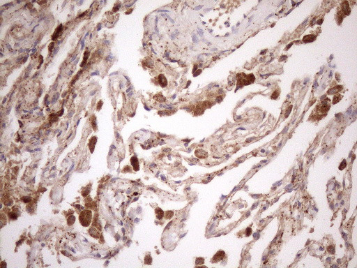 KCTD9 Antibody in Immunohistochemistry (Paraffin) (IHC (P))