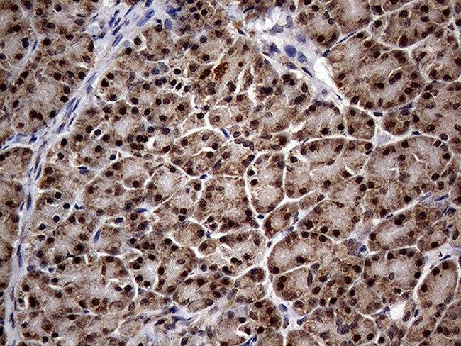 KCTD9 Antibody in Immunohistochemistry (Paraffin) (IHC (P))