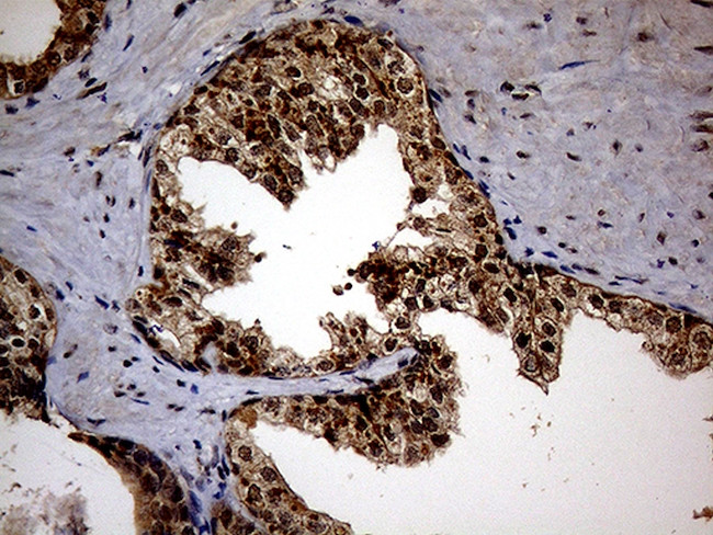 KCTD9 Antibody in Immunohistochemistry (Paraffin) (IHC (P))