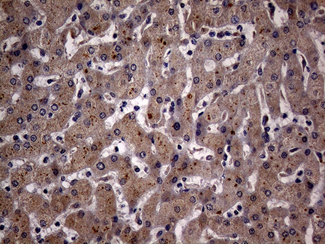 KCTD9 Antibody in Immunohistochemistry (Paraffin) (IHC (P))