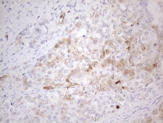 KCTD9 Antibody in Immunohistochemistry (Paraffin) (IHC (P))