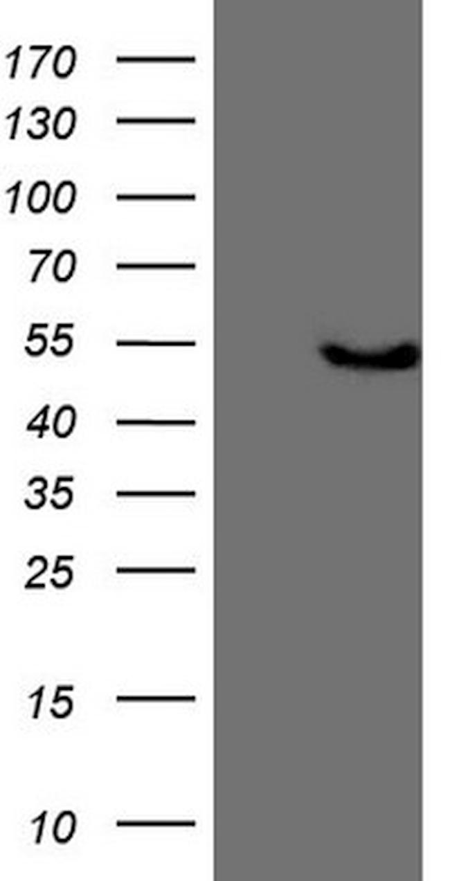 KCTD9 Antibody in Western Blot (WB)