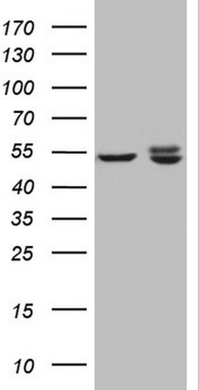 KCTD9 Antibody in Western Blot (WB)