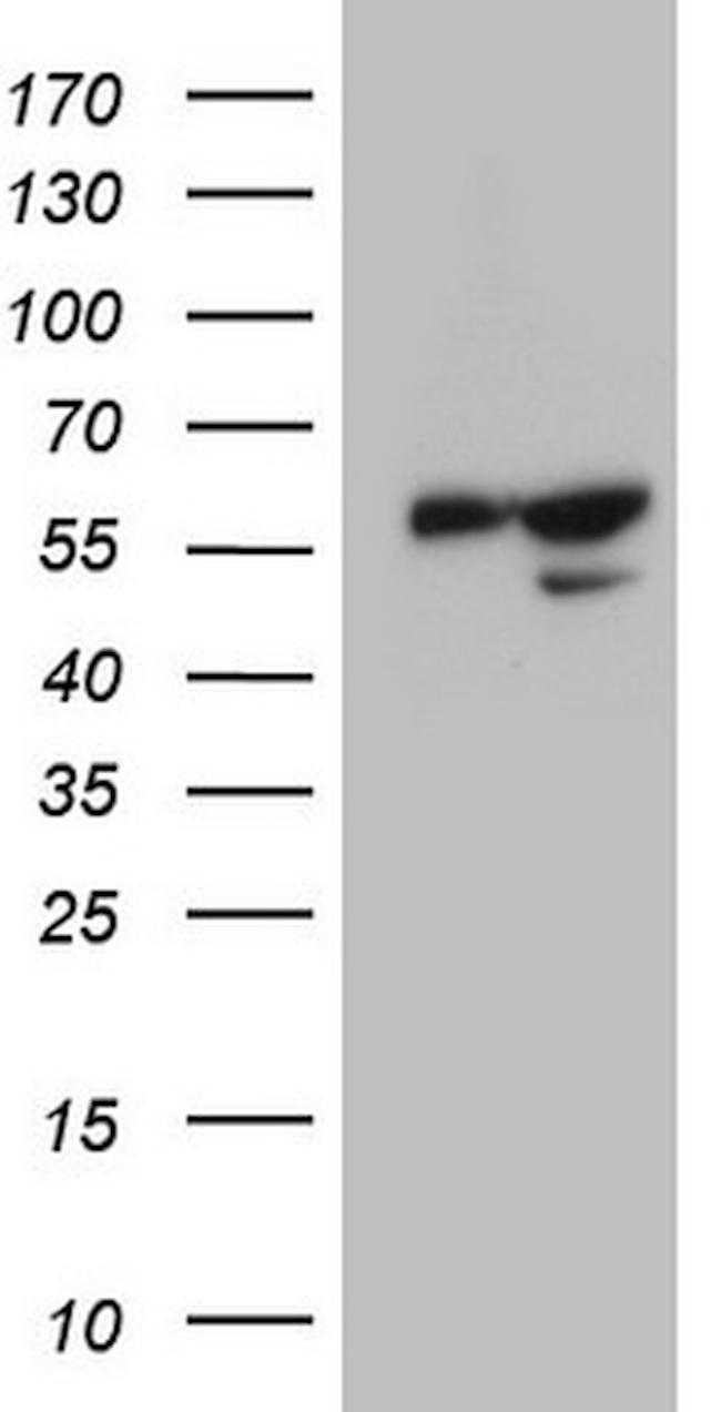 KCTD9 Antibody in Western Blot (WB)