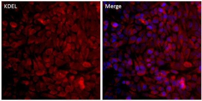 KDEL Antibody in Immunocytochemistry (ICC/IF)