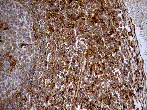 KDELC2 Antibody in Immunohistochemistry (Paraffin) (IHC (P))