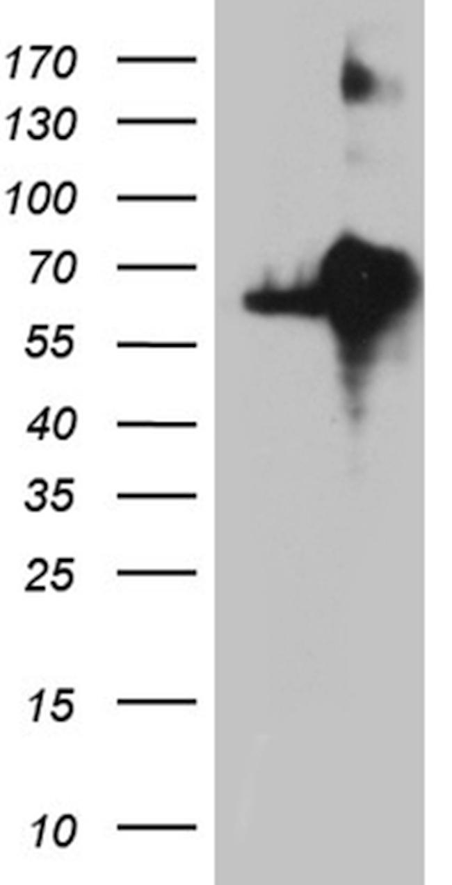 KDELC2 Antibody in Western Blot (WB)