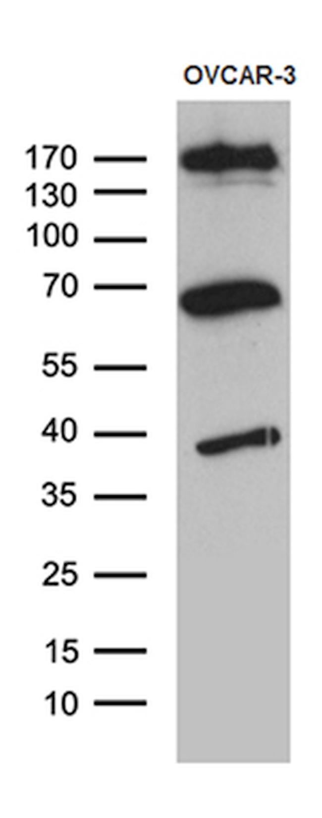 KDELC2 Antibody in Western Blot (WB)