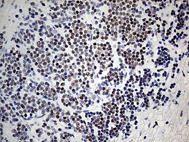 KDM3A Antibody in Immunohistochemistry (Paraffin) (IHC (P))