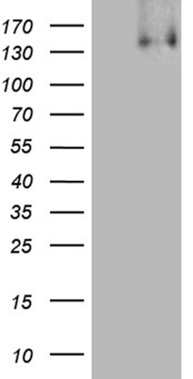 KDM3A Antibody in Western Blot (WB)