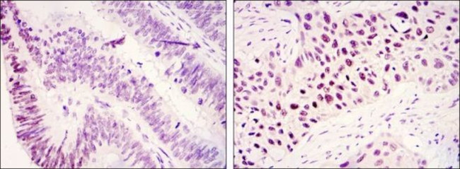 JMJD1A Antibody in Immunohistochemistry (Paraffin) (IHC (P))