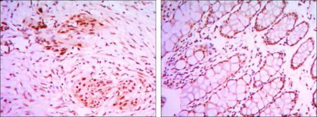 JMJD2A Antibody in Immunohistochemistry (Paraffin) (IHC (P))