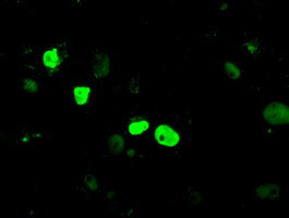 KDM4C Antibody in Immunocytochemistry (ICC/IF)