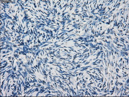 KDM4C Antibody in Immunohistochemistry (Paraffin) (IHC (P))