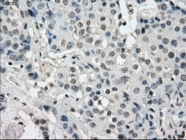 KDM4C Antibody in Immunohistochemistry (Paraffin) (IHC (P))