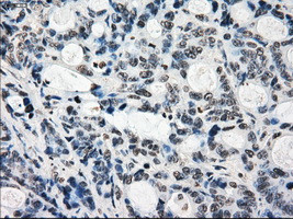 KDM4C Antibody in Immunohistochemistry (Paraffin) (IHC (P))