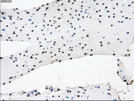 KDM4C Antibody in Immunohistochemistry (Paraffin) (IHC (P))