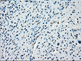 KDM4C Antibody in Immunohistochemistry (Paraffin) (IHC (P))