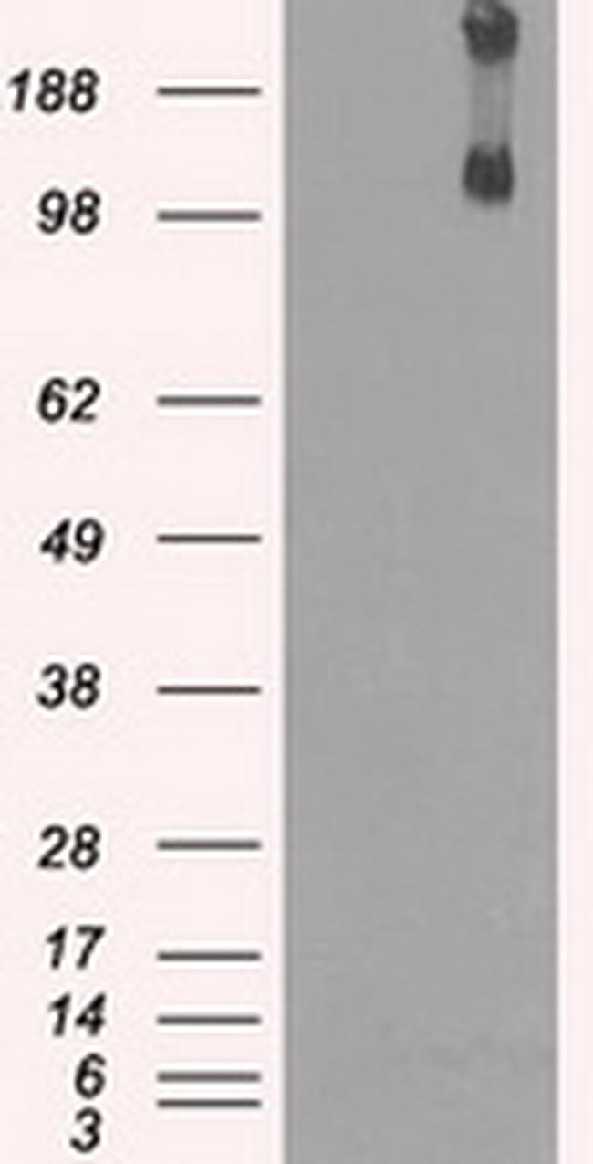 KDM4C Antibody in Western Blot (WB)