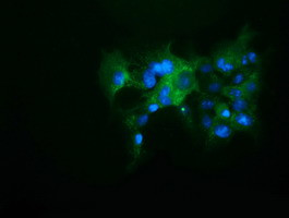 KEAP1 Antibody in Immunocytochemistry (ICC/IF)