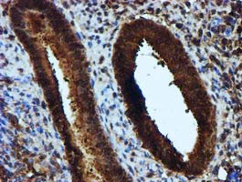 KEAP1 Antibody in Immunohistochemistry (Paraffin) (IHC (P))