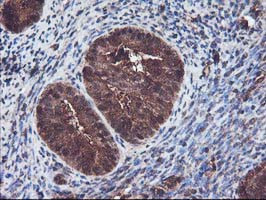 KEAP1 Antibody in Immunohistochemistry (Paraffin) (IHC (P))