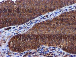 KEAP1 Antibody in Immunohistochemistry (Paraffin) (IHC (P))