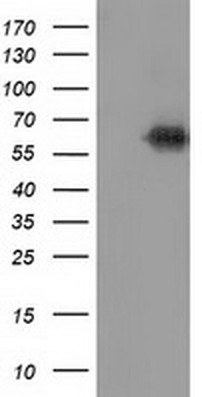 KEAP1 Antibody in Western Blot (WB)