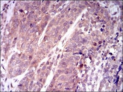 KEAP1 Antibody in Immunohistochemistry (Paraffin) (IHC (P))