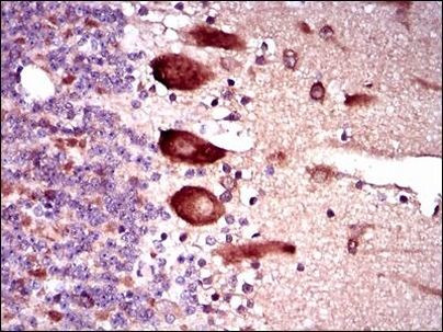 KEAP1 Antibody in Immunohistochemistry (Paraffin) (IHC (P))