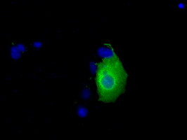 KHK Antibody in Immunocytochemistry (ICC/IF)