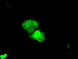 KHK Antibody in Immunocytochemistry (ICC/IF)