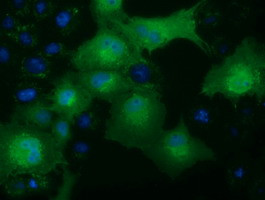 KHK Antibody in Immunocytochemistry (ICC/IF)