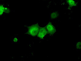 KHK Antibody in Immunocytochemistry (ICC/IF)