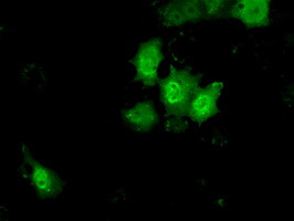 KHK Antibody in Immunocytochemistry (ICC/IF)