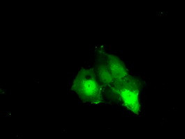 KHK Antibody in Immunocytochemistry (ICC/IF)