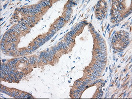 KHK Antibody in Immunohistochemistry (Paraffin) (IHC (P))