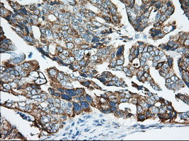 KHK Antibody in Immunohistochemistry (Paraffin) (IHC (P))