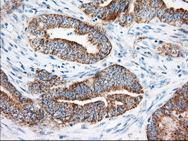 KHK Antibody in Immunohistochemistry (Paraffin) (IHC (P))