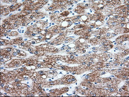 KHK Antibody in Immunohistochemistry (Paraffin) (IHC (P))