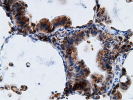 KHK Antibody in Immunohistochemistry (Paraffin) (IHC (P))