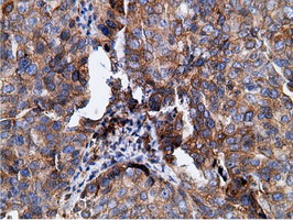 KHK Antibody in Immunohistochemistry (Paraffin) (IHC (P))