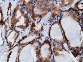 KHK Antibody in Immunohistochemistry (Paraffin) (IHC (P))