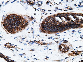 KHK Antibody in Immunohistochemistry (Paraffin) (IHC (P))