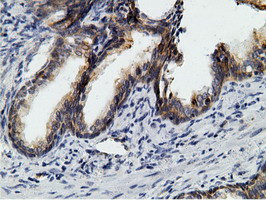 KHK Antibody in Immunohistochemistry (Paraffin) (IHC (P))