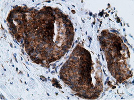 KHK Antibody in Immunohistochemistry (Paraffin) (IHC (P))