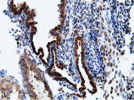 KHK Antibody in Immunohistochemistry (Paraffin) (IHC (P))