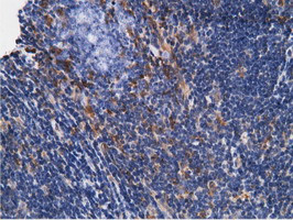 KHK Antibody in Immunohistochemistry (Paraffin) (IHC (P))